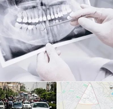 رادیولوژی دهان و دندان در سیدی مشهد