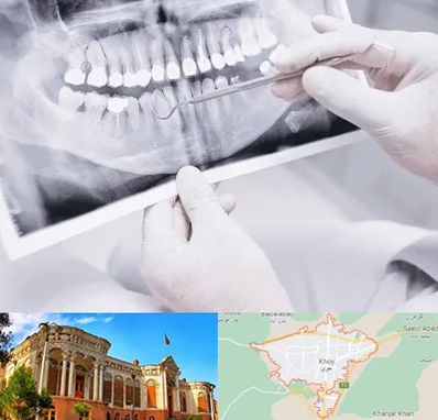 رادیولوژی دهان و دندان در خوی