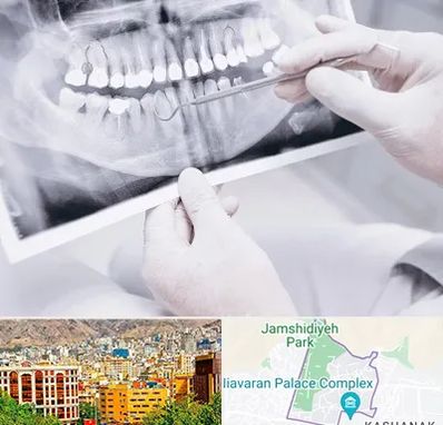 رادیولوژی دهان و دندان در نیاوران 