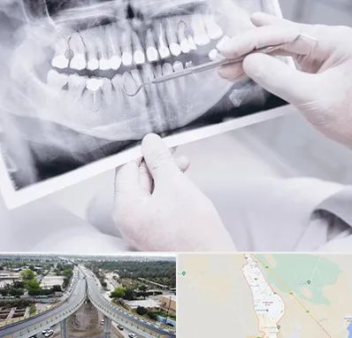 رادیولوژی دهان و دندان در اندیمشک