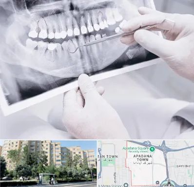 رادیولوژی دهان و دندان در آپادانا