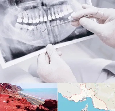 رادیولوژی دهان و دندان در هرمزگان