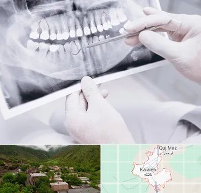 رادیولوژی دهان و دندان در کلاله
