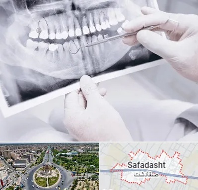 رادیولوژی دهان و دندان در صفادشت
