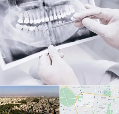 رادیولوژی دهان و دندان در نازی آباد