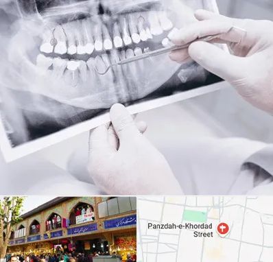رادیولوژی دهان و دندان در 15 خرداد