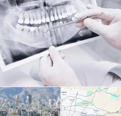 رادیولوژی دهان و دندان در شمال شرق تهران