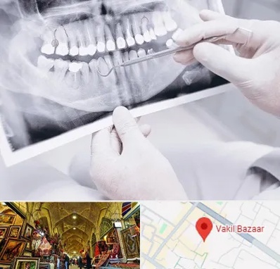 رادیولوژی دهان و دندان در بازار وکیل شیراز