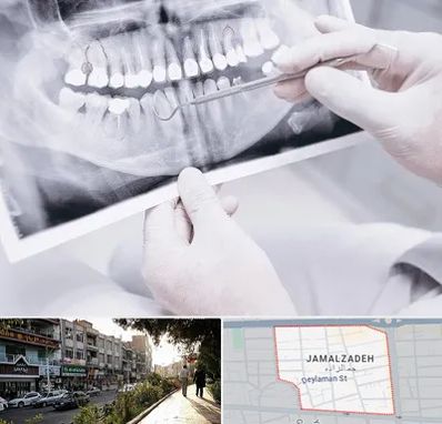 رادیولوژی دهان و دندان در خیابان جمالزاده