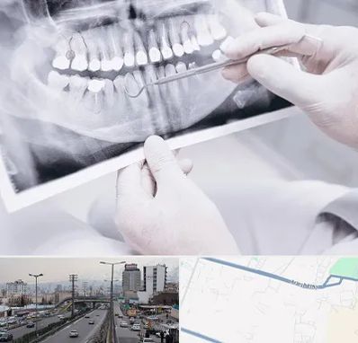 رادیولوژی دهان و دندان در بلوار ارتش