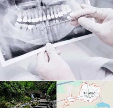 رادیولوژی دهان و دندان در علی آباد کتول