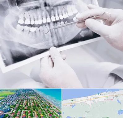 رادیولوژی دهان و دندان در فریدونکنار