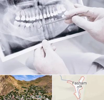 رادیولوژی دهان و دندان در فشم