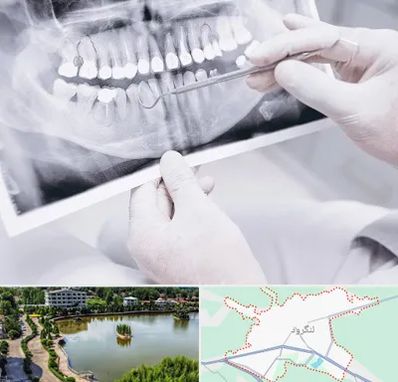 رادیولوژی دهان و دندان در لنگرود