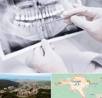 رادیولوژی دهان و دندان در گرگان