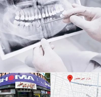 رادیولوژی دهان و دندان در امین حضور