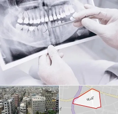 رادیولوژی دهان و دندان در آذری
