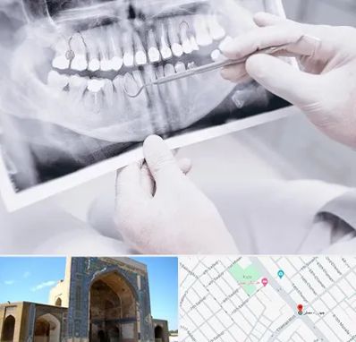 رادیولوژی دهان و دندان در مصلی مشهد
