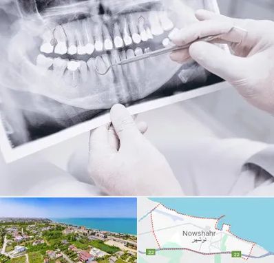 رادیولوژی دهان و دندان در نوشهر