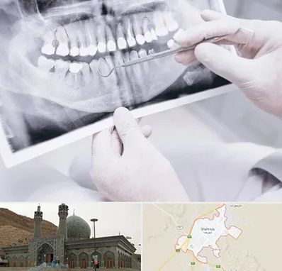 رادیولوژی دهان و دندان در شهرضا