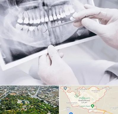 رادیولوژی دهان و دندان در شهرکرد