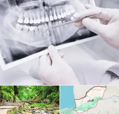 رادیولوژی دهان و دندان در گلستان