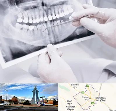 رادیولوژی دهان و دندان در تایباد