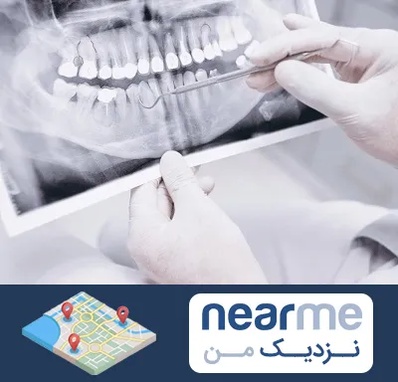 رادیولوژی دهان و دندان در نزدیک من