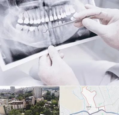 رادیولوژی دهان و دندان در اوین