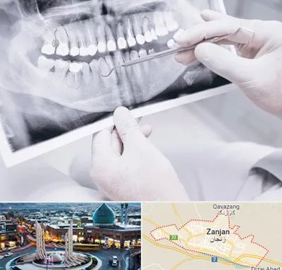 رادیولوژی دهان و دندان در زنجان