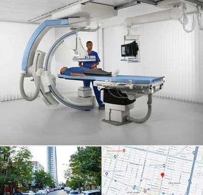 فلوروسکوپی در امامت مشهد