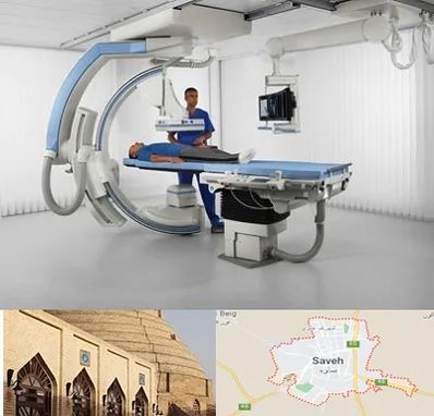 فلوروسکوپی در ساوه