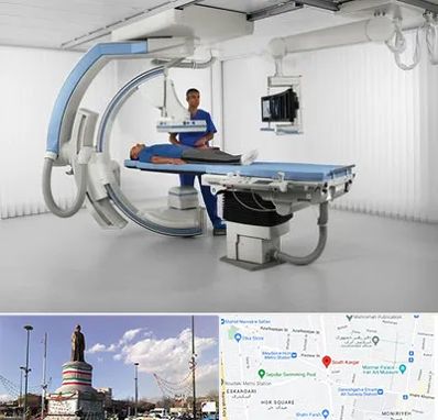 فلوروسکوپی در کارگر جنوبی