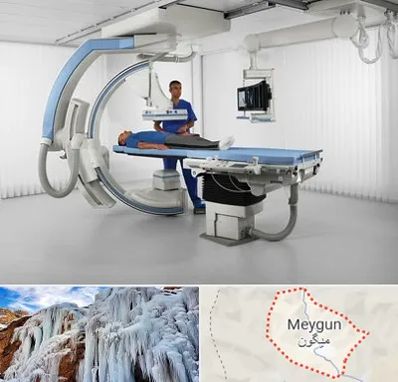 فلوروسکوپی در میگون