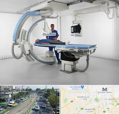 فلوروسکوپی در جنوب تهران 