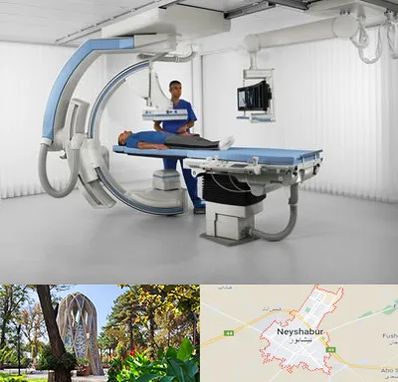 فلوروسکوپی در نیشابور