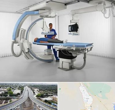 فلوروسکوپی در اندیمشک