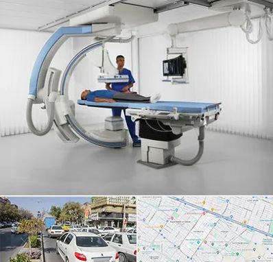 فلوروسکوپی در مفتح مشهد