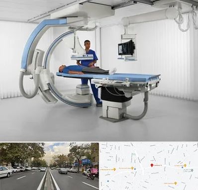 فلوروسکوپی در دولت