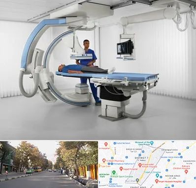 فلوروسکوپی در شریعتی 
