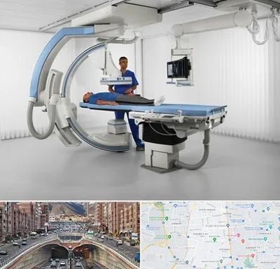 فلوروسکوپی در منطقه 10 تهران