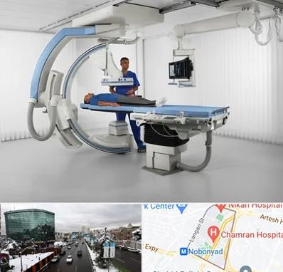 فلوروسکوپی در اقدسیه 