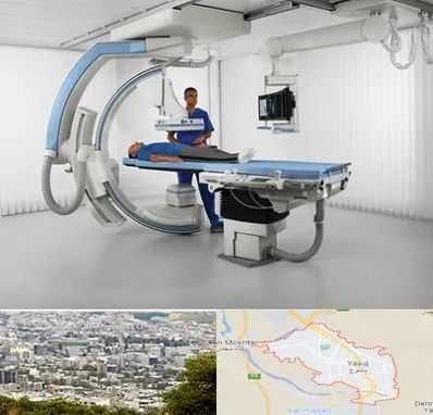 فلوروسکوپی در یاسوج