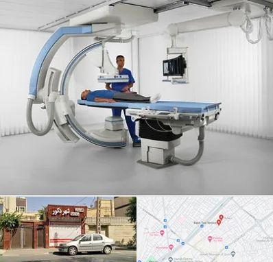 فلوروسکوپی در باجک قم