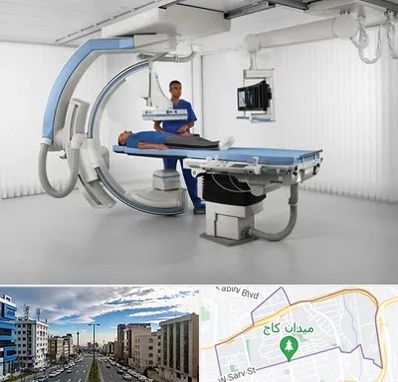 فلوروسکوپی در سعادت آباد 