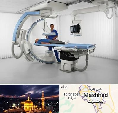 فلوروسکوپی در مشهد