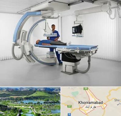 فلوروسکوپی در خرم آباد