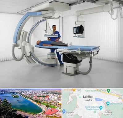 فلوروسکوپی در لاهیجان