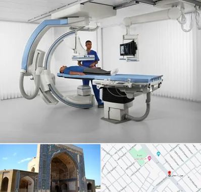 فلوروسکوپی در مصلی مشهد