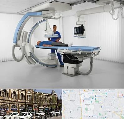 فلوروسکوپی در منطقه 11 تهران